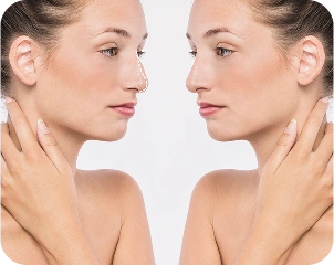 rhinoplasty-surgery-concept-with-woman-model 1