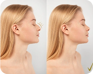 woman-getting-ready-nose-job-surgery 1